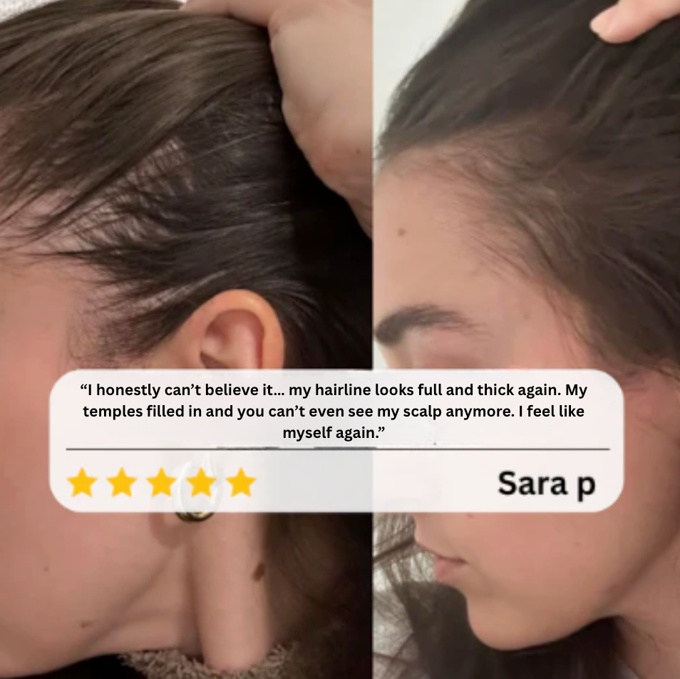 Ardena™️ Hair Growth Roll Serum